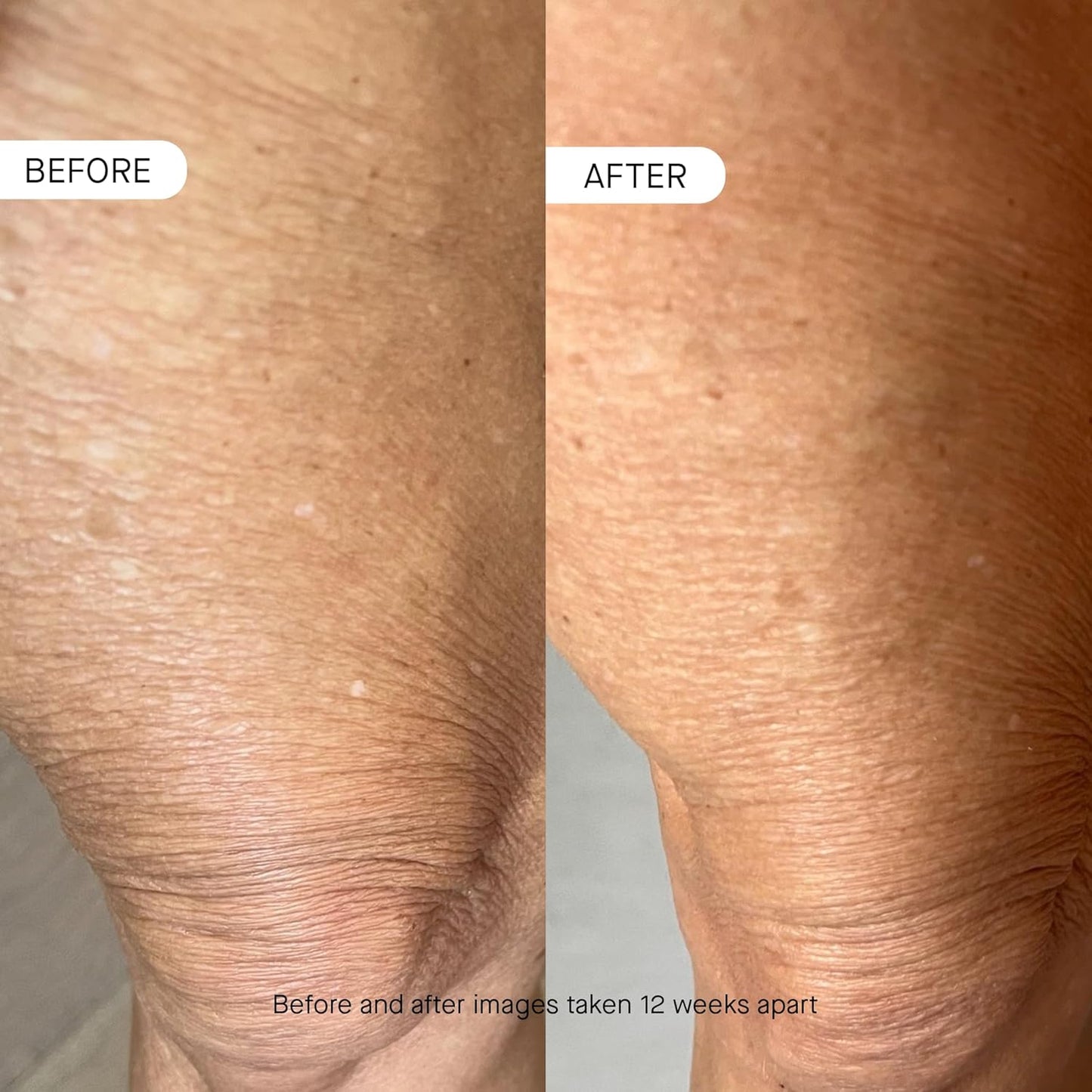 OneSkin BODY OS-01 Peptide Topical Supplement