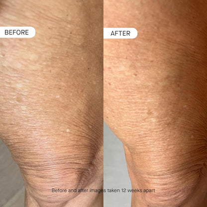 OneSkin BODY OS-01 Peptide Topical Supplement